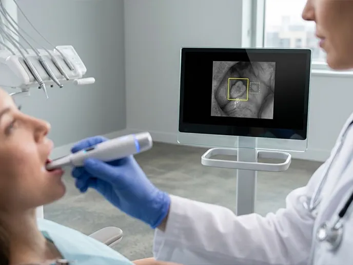 Dentist with blue gloves using an intraoral scanner in a patient’s mouth; monitor shows a dental scan with highlighted area.